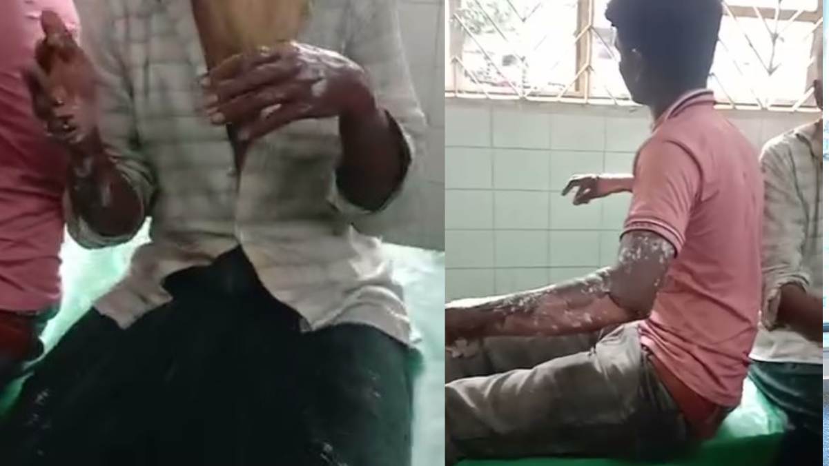 রাজশাহীতে গ্যাসের বেলুন বিস্ফোরণে দগ্ধ ৭
