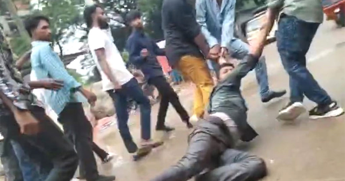 গাজীপুরে আরেক সাংবাদিকের পা ইট দিয়ে থেঁতলে দিয়েছে দুর্বৃত্তরা
