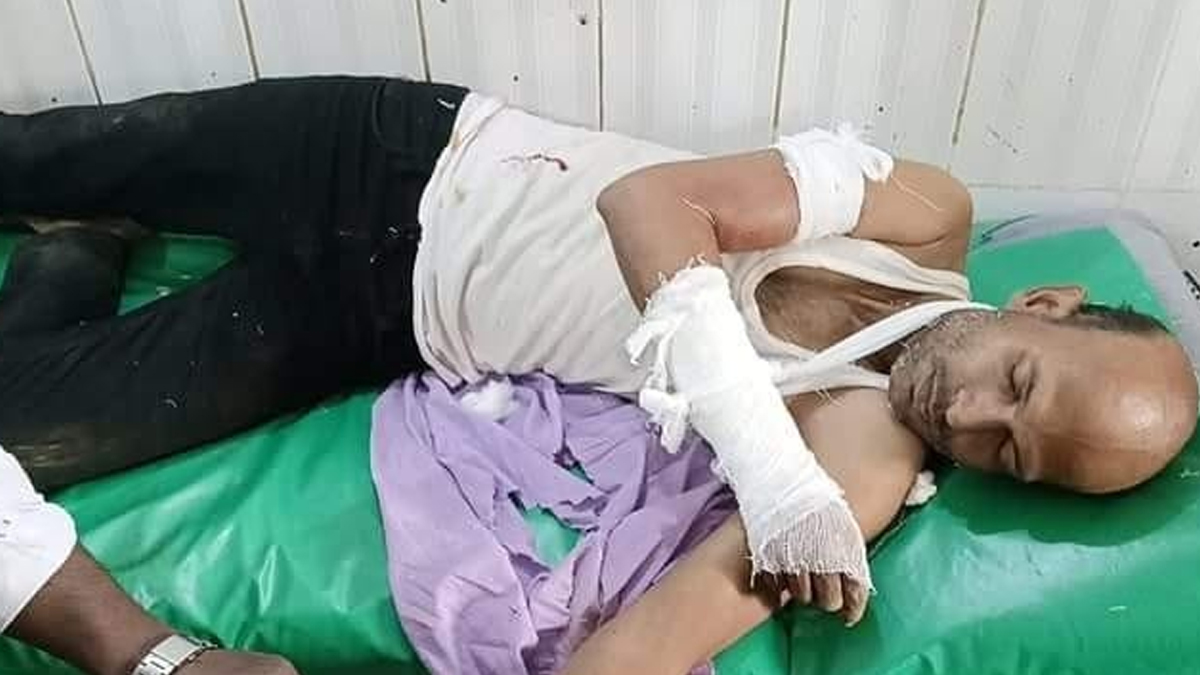 দুর্বৃত্তদের হামলায় সাংবাদিক আহত