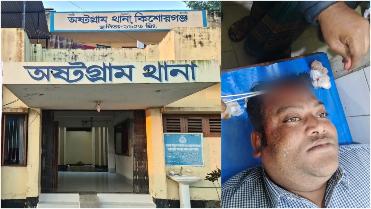 জলমহাল দখল নিয়ে সংঘর্ষ, ছাত্রদল নেতাসহ  আহত ৪