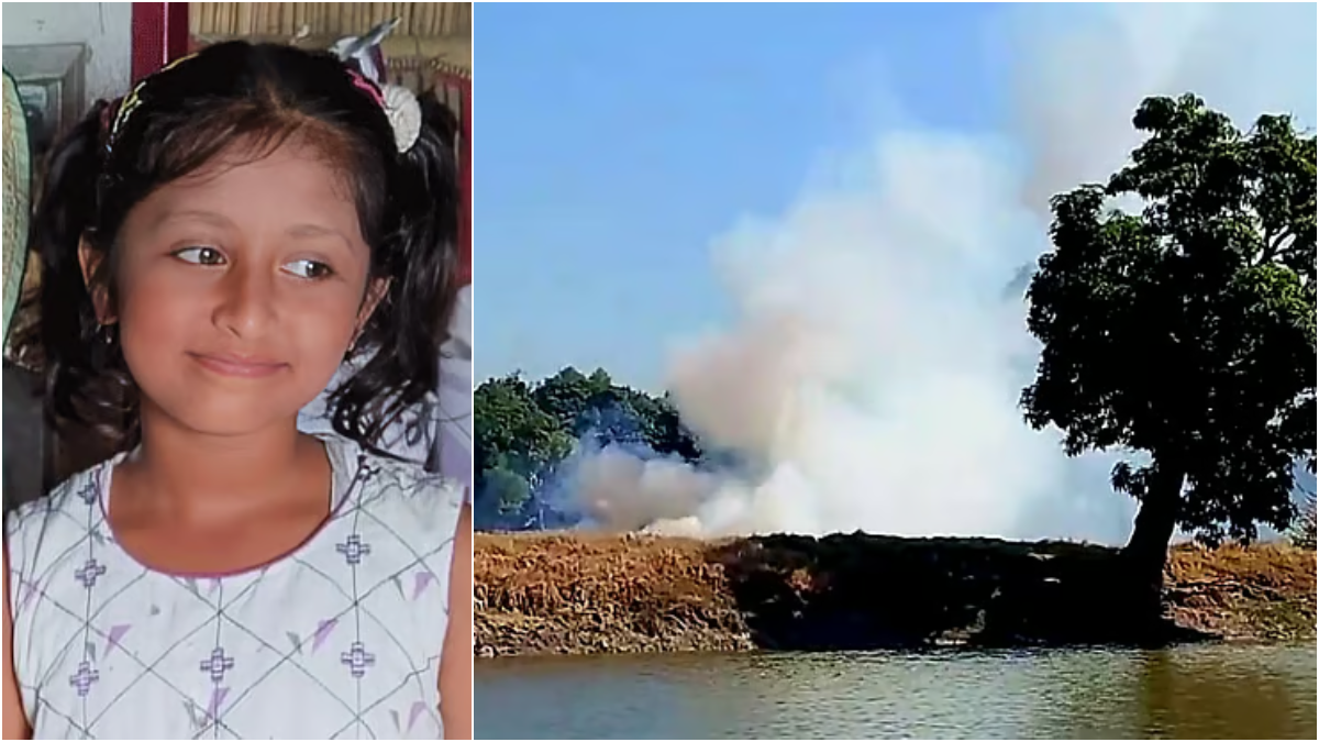 অস্ত্রোপচারের পরও গুলি রয়ে গেছে শিশু হুজাইফার মস্তিষ্কে