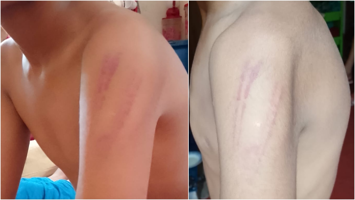 গান গাইতে না পারায় ক্ষোভ, ধর্মীয় শিক্ষকের লাঠিপেটায় আহত শিক্ষার্থী