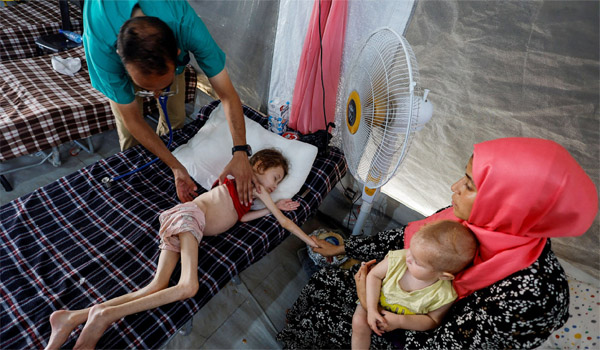 গাজায় দুর্ভিক্ষে অন্তত ৩৩ শিশুর মৃত্যু : জাতিসংঘ