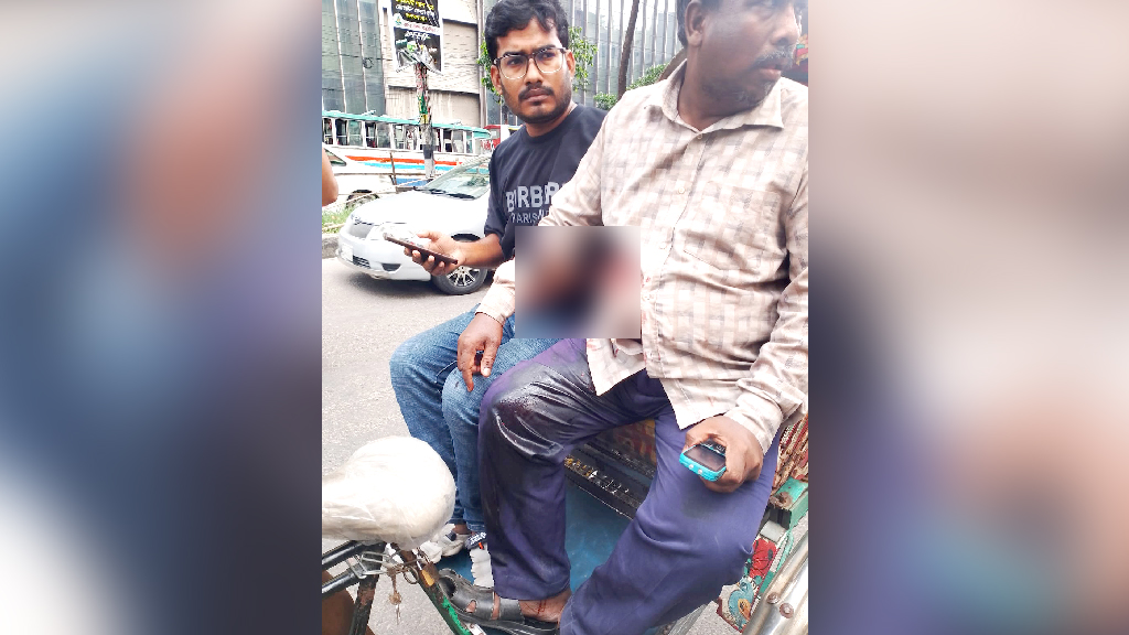 মতিঝিলে প্রকাশ্যে গুলি করে টাকা ছিনতাই, হাসপাতালে ভুক্তভোগী