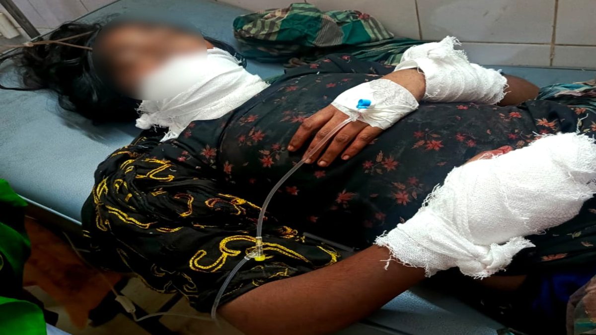 বিয়ের প্রস্তাব প্রত্যাখ্যান করায় কিশোরীকে কুপিয়ে জখম, গ্রেফতার ৩