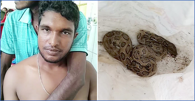 কামড় খেয়ে রাসেল ভাইপার নিয়ে হাসপাতালে যুবক
