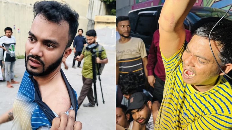 এফডিসিতে সংবাদকর্মীদের অতর্কিত ওপর হামলা
