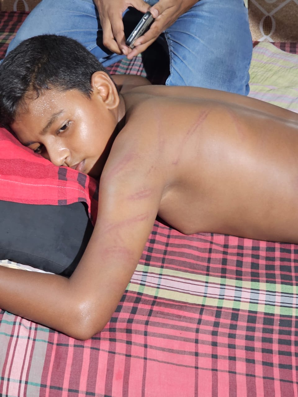 স্কুলছাত্রকে বেধড়ক পিটিয়ে হাসপাতালে পাঠালেন প্রধান শিক্ষক!