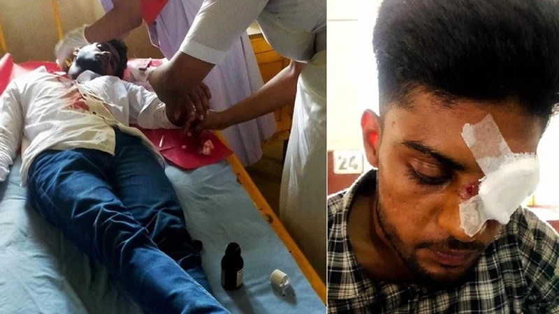 টাঙ্গাইলে ছাত্রলীগের হামলায় তিন সমন্বয়ক আহত